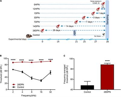 Stress Response and Hearing Loss Differentially Contribute to Dynamic Alterations in Hippocampal Neurogenesis and Microglial Reactivity in Mice Exposed to Acute Noise Exposure
